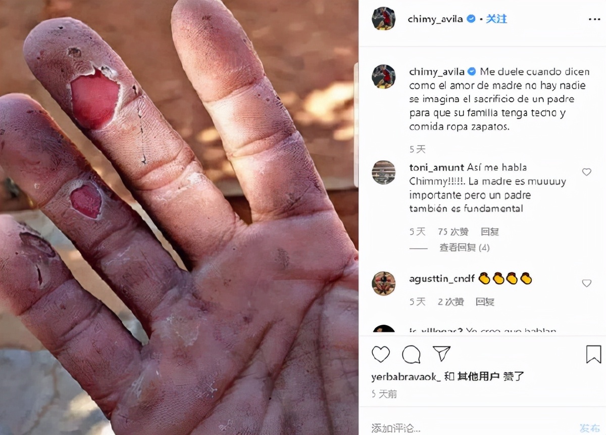 因为重伤无缘搭档梅西：曾为救女儿放弃足球的他，再一次战胜命运