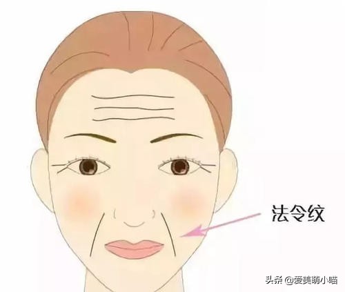 法令纹深有什么拯救方法,减肥脸上出现法令纹怎么拯救