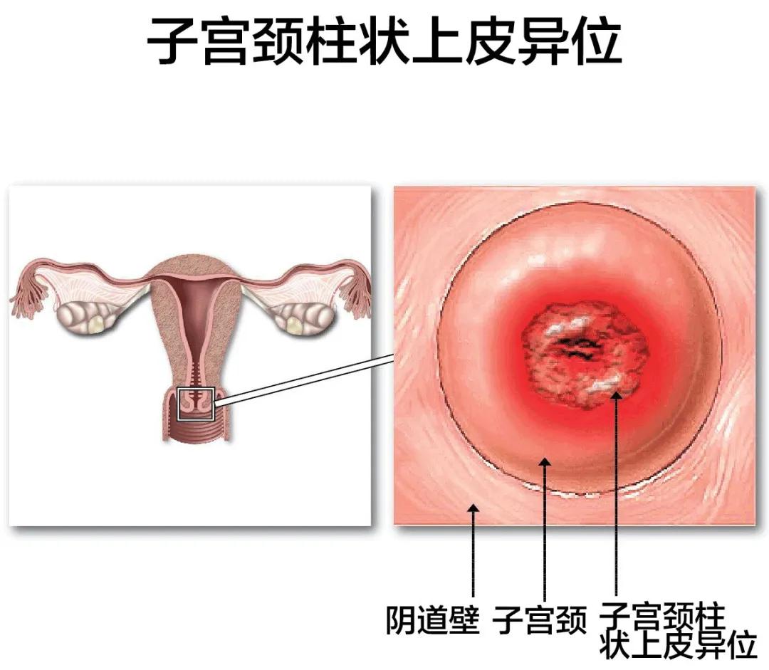 为了骗你钱，*子骗**们捏造了这些病