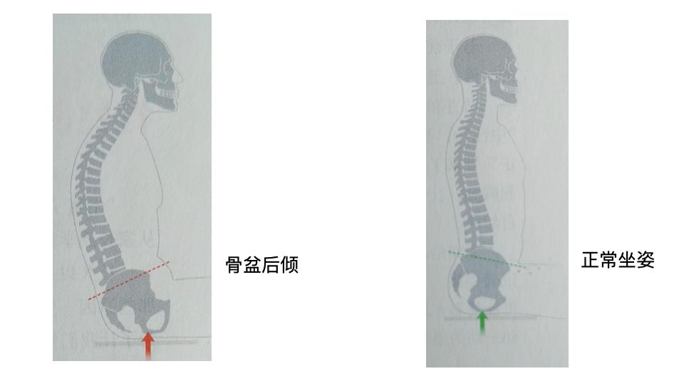 你的坐姿十有八九有问题，肩膀、背部酸痛？教你几招来缓解