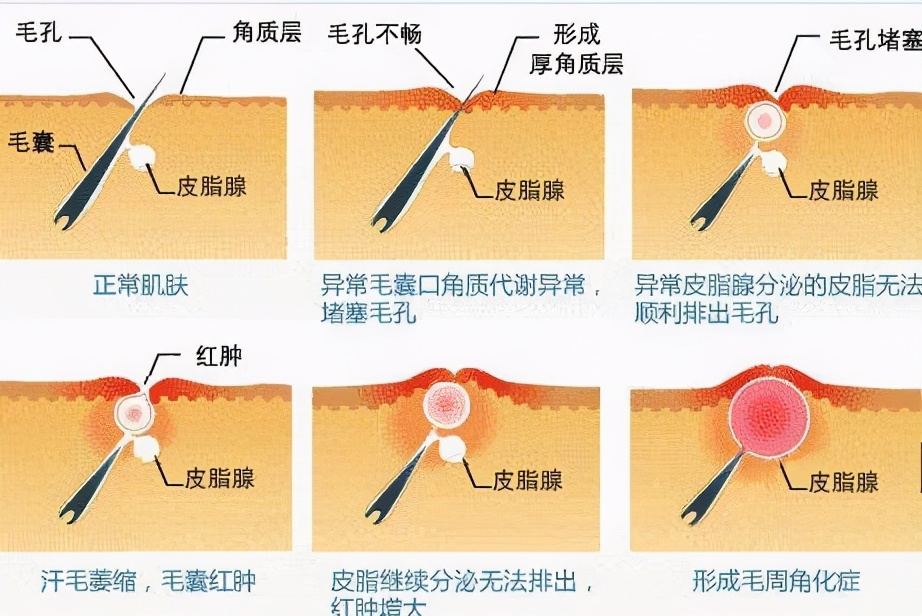 如何拥有好的皮肤教你这几招,怎样才能拥有白白净净的皮肤
