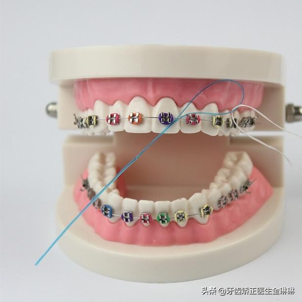 牙齿动态图,最好看最标准的牙齿是什么样的