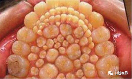 拔牙后的十大注意事项,月经期拔牙注意事项与禁忌症