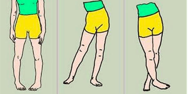 孩子腿不直xo型腿,小孩腿o型腿是怎么导致的