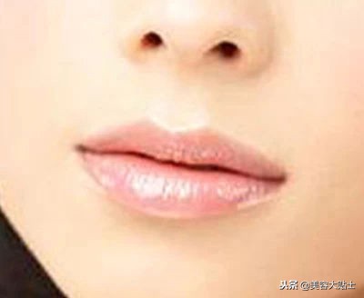 冬季嘴唇干燥起皮的妙招,秋冬嘴唇起皮怎么防止