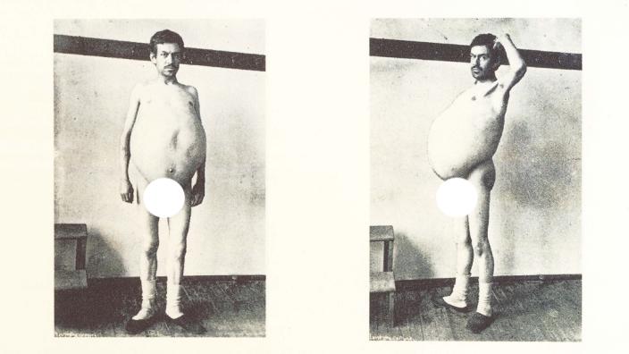 爱因斯坦的大脑解剖全过程,爱因斯坦的大脑为科学奉献一生