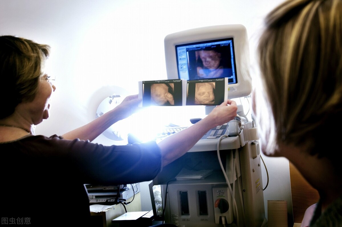 什么是阴超检查呀,做阴式b超可以看出宫腔粘连吗