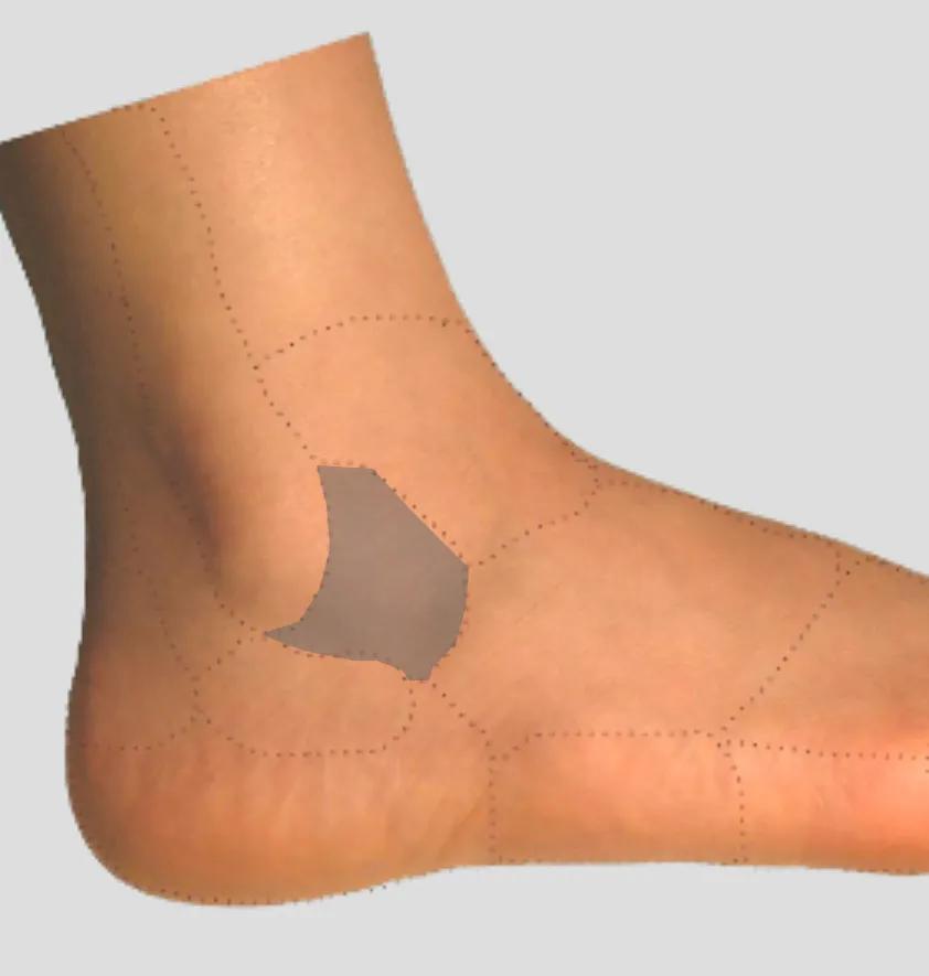 足踝各种疼痛的原因,足踝内侧疼痛自测