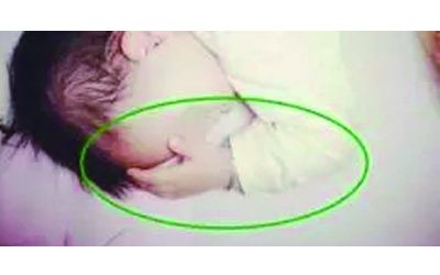 手部红点、红斑、肿胀、溃烂？影响一生幸福的罪魁祸首