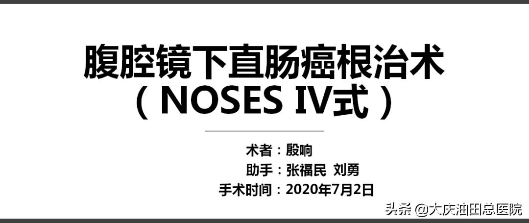 84岁老人直肠癌微创手术,直肠癌手术成功无转移