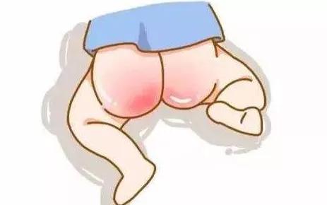 一招轻松搞定宝宝红屁屁,树袋宝宝视频
