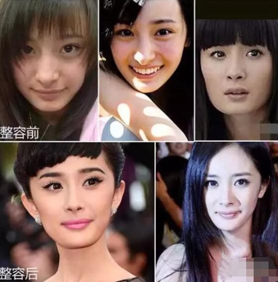 鹰钩鼻很丑吗,鹰钩鼻丑陋