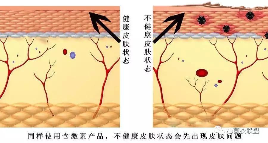 面部红血丝丘疹,白眼圈透红是什么原因