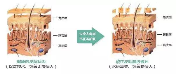 角质层薄容易过敏,角质层薄适合的水