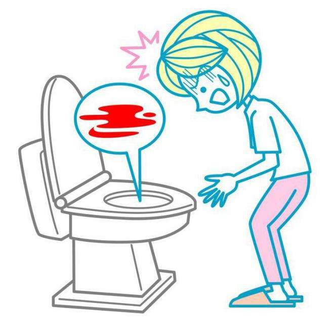 痔疮误诊成直肠癌的概率大吗,直肠癌被误诊为痔疮赔多少