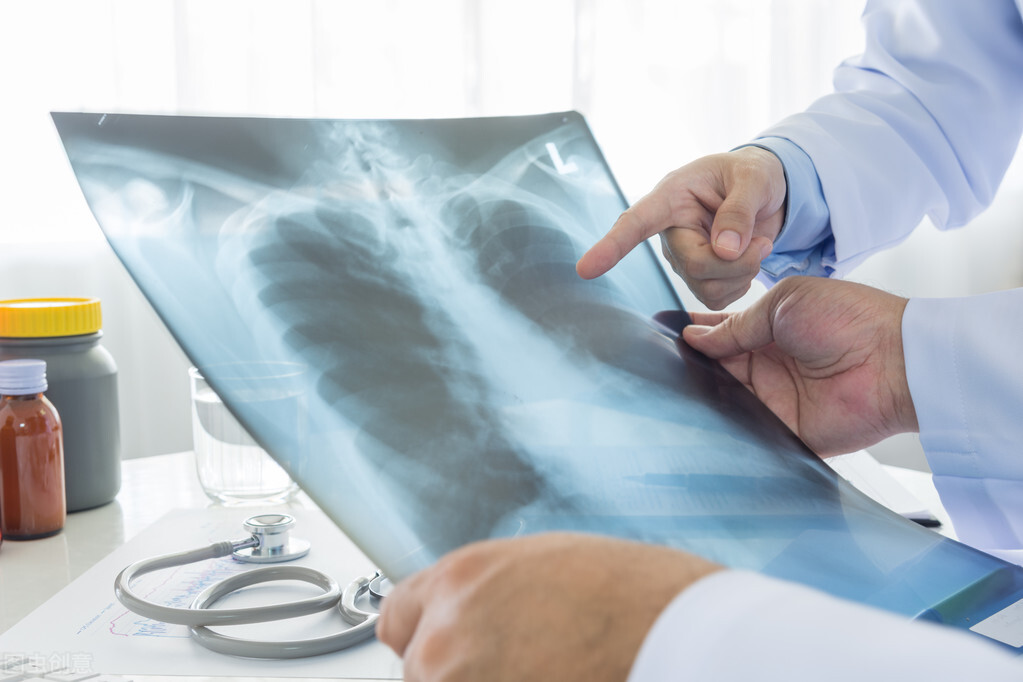 工伤死亡赔偿要准备哪些材料,工伤理赔需要准备什么材料