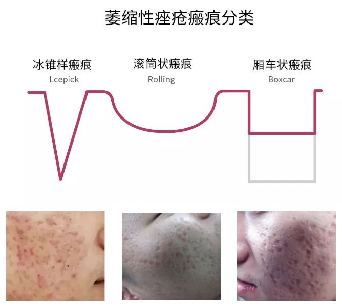 高考生凭借准考证优惠688元,高考生准考证的优惠广东