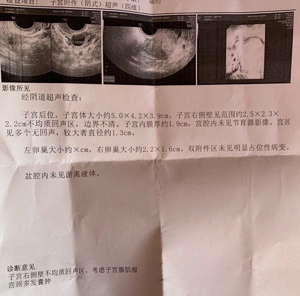 痛经几十年忽然好了咋回事,经量增多经期延长见于哪些病
