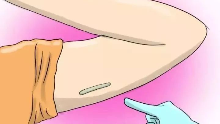 各种类型避孕药的区别,各种避孕药药丸类型