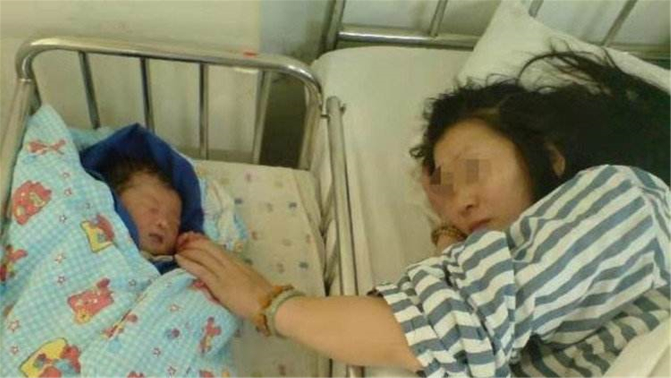 宝宝产钳的印子,宝宝产钳印