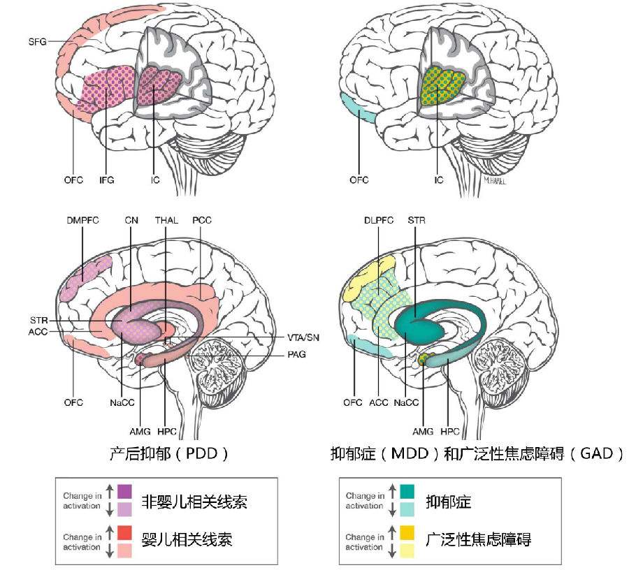 产后抑郁不是矫情,妇女产后重度抑郁不是矫情