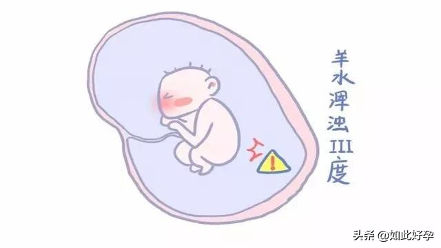 孕妈有这些表现，很可能是羊水出现大问题，要立刻去医院