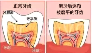 两侧脸不对称是病吗,脸部百分之一的不对称正常吗