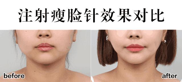 2人同行一人免单北京生日,厦门2人同行1人免单