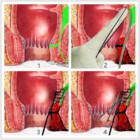长大后我就成了你对口型歌曲,长大后我就成了你对口型男版