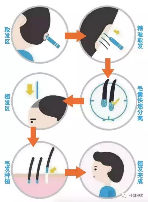 保护好自己头发,保护好自己乌黑的头发