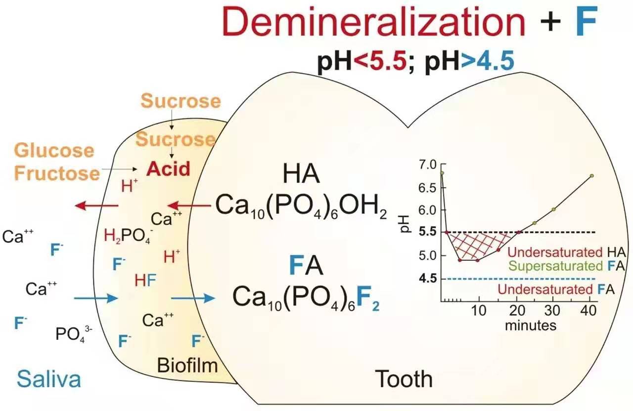 为什么牙齿会蛀牙儿童科普,儿童牙齿长白点是蛀牙吗