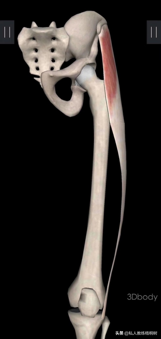 肌肉起止点,肌肉起止点松解