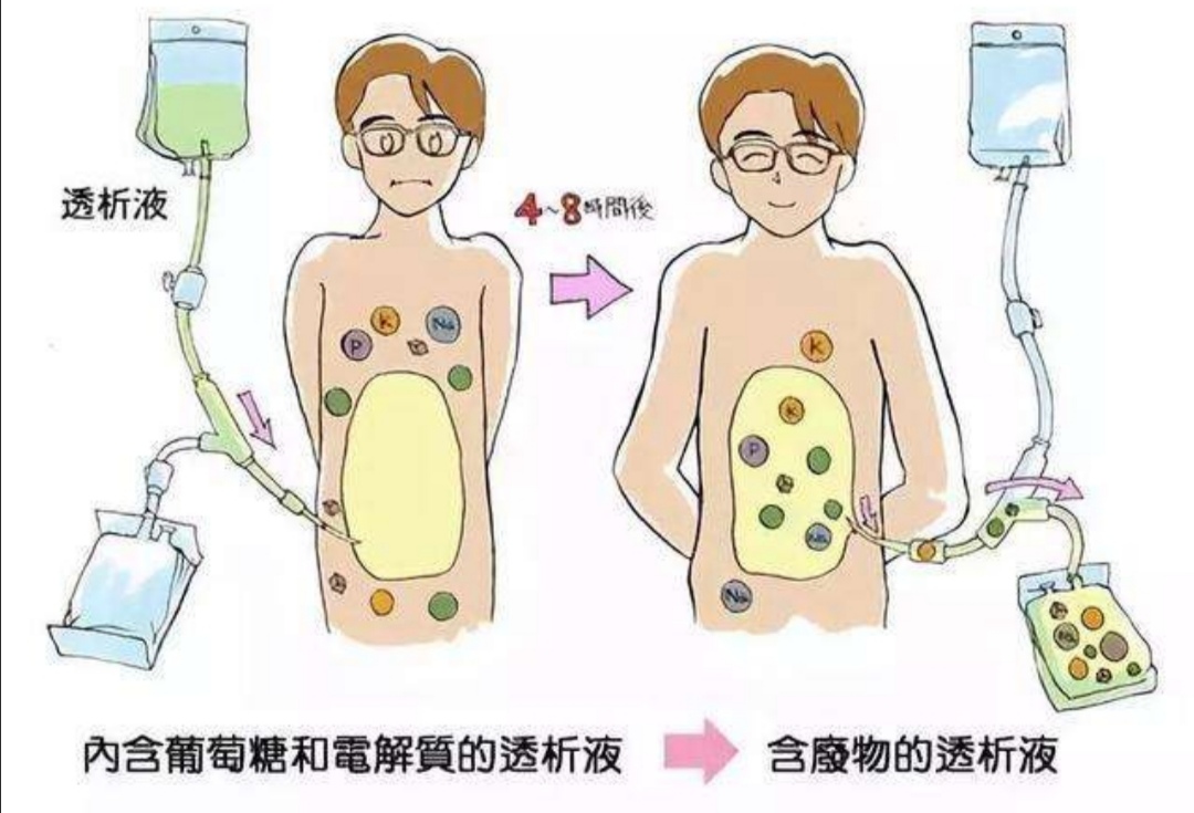 高钾血症的表现,高钾血症紧急处理