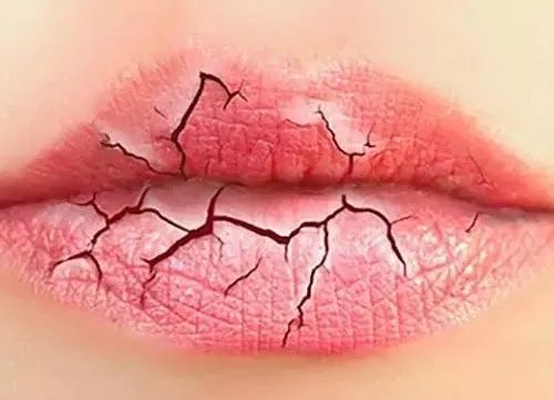 嘴唇干裂对应的身体脏腑是哪个,嘴唇总起皮器官发出信号
