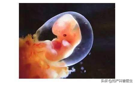 怀孕四十天流血医生说保胎,怀孕31天流血还需要保胎吗