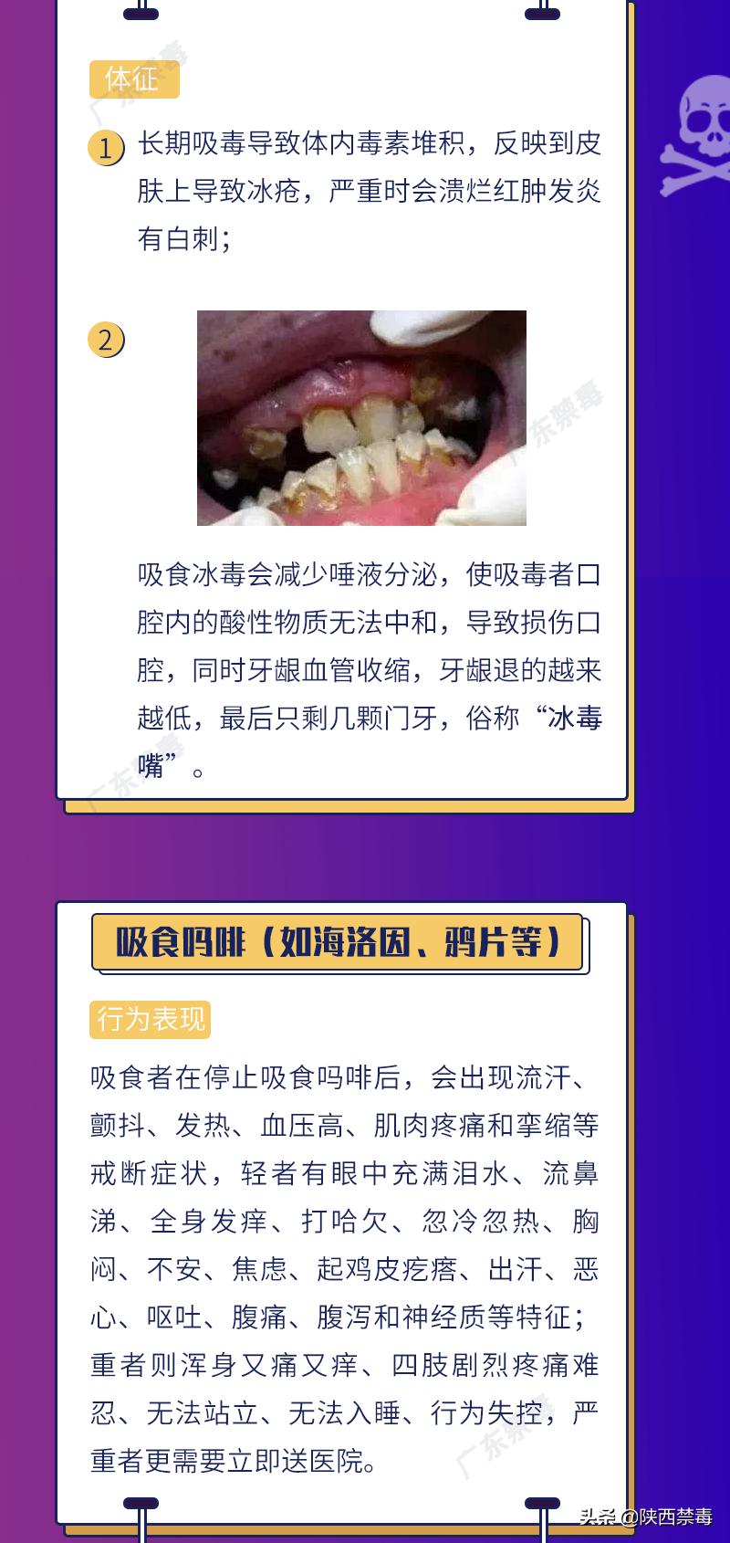 “别动!你的黑眼圈出卖了你!”