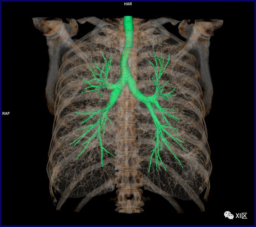如此详细的肺部影像解剖，有点儿酷！