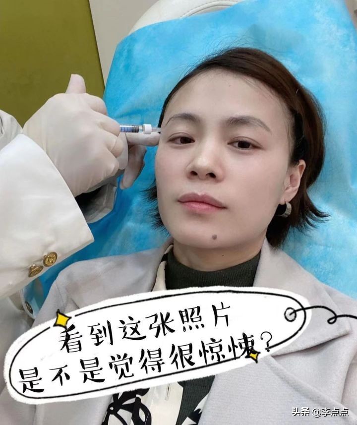 熬夜写完了医美后续，美真的是要付出代价的