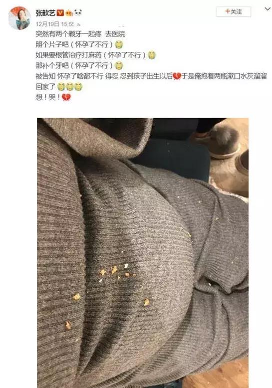张歆艺孕期牙齿疼,张歆艺说孕期