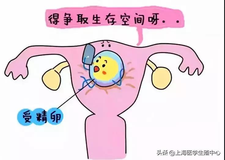 怀孕宫腔粘连怎么办,宫腔粘连会怀孕吗