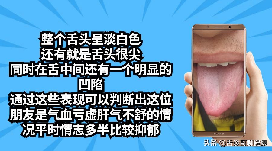 尿路结石口干舌燥恶心,尿路结石导致恶心呕吐不尿尿