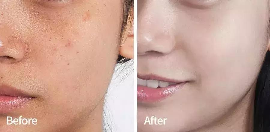 沈梦辰美白精华,沈梦辰推荐的美白精华液