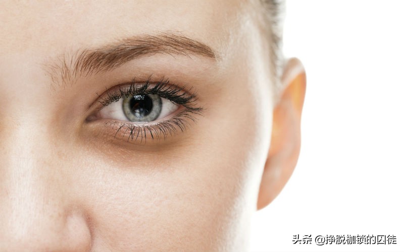 女孩黑眼圈重什么原因造成的,中医认为黑眼圈是什么原因造成的