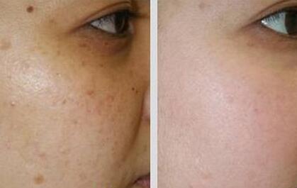 安耐晒防晒霜防过敏,安耐晒防晒国产