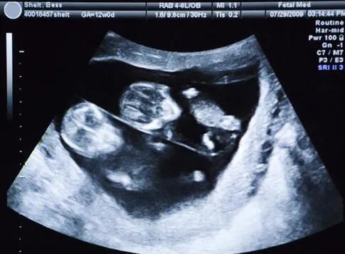 如何让腿变长视频,如何让腿变长变好看