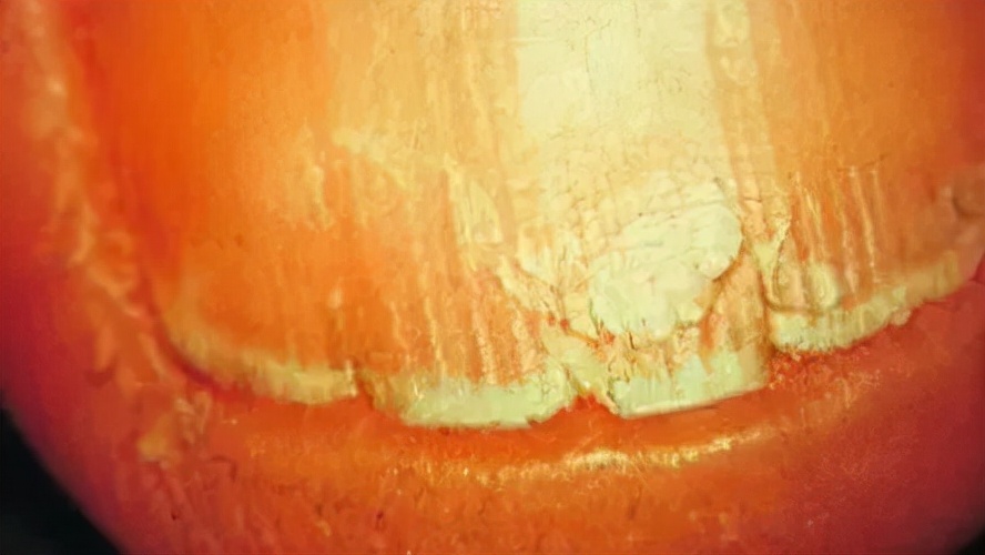 想让指甲长得快些怎么办,想让指甲变好看怎么办