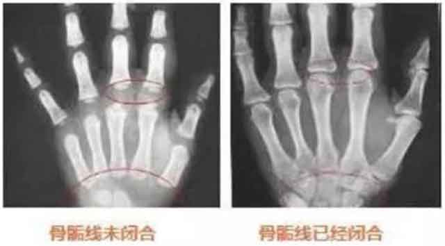 帮助孩子长高的最有效方法,闻柠檬能帮助孩子长高吗