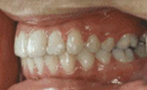 嘴形状看面相,嘴型区分