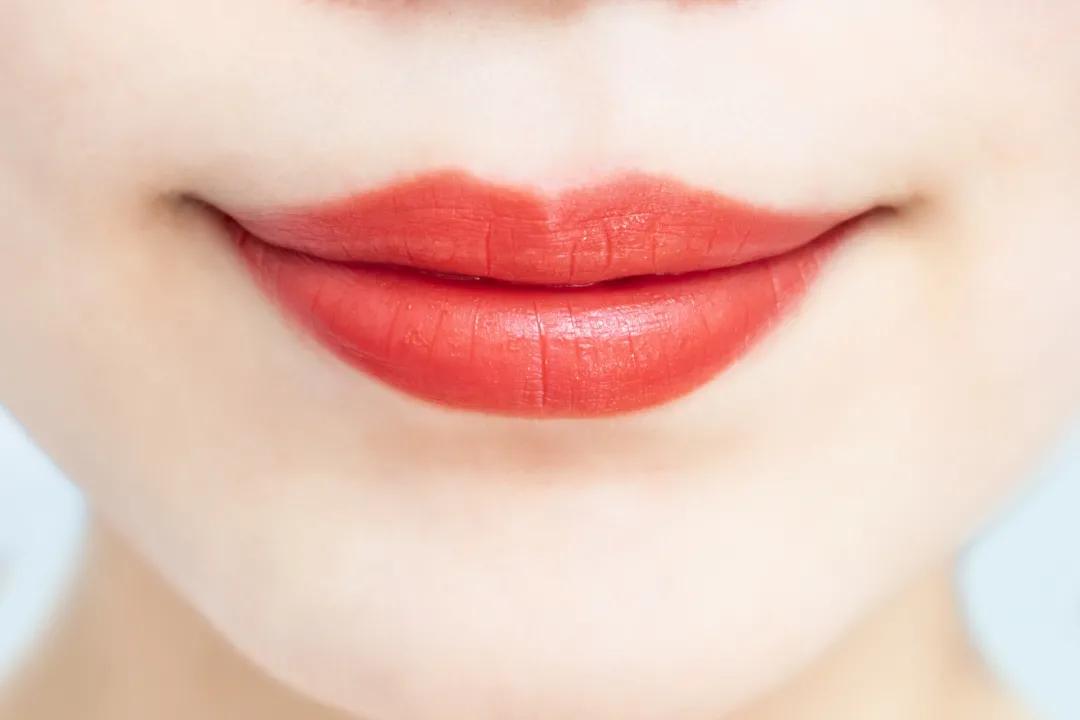 麦迪森为什么身上痒,麦迪森健康