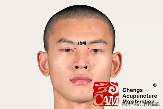 面瘫面神经炎中医调理方法,小儿面神经炎中医如何治疗